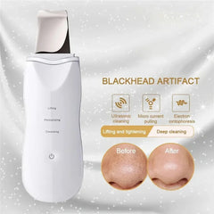 Ultra Portable Ultrasonic Deep Cleaning Face Scrubber for Beauty Personal Care - USB Rechargeable Skin Scrubber with Dermabrasio